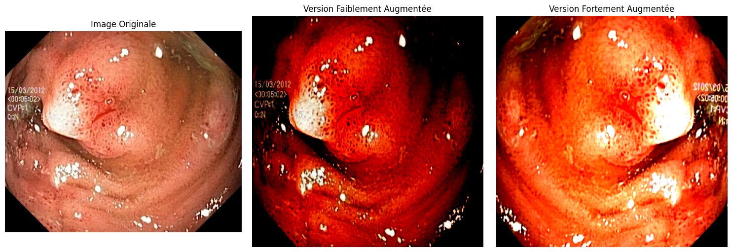3 images sont affichées. La première est l'image originale. La seconde présente une augmentation faible (un changement de contraste). La troisième présente une augmentation forte (un retournement et un ajustement de couleur).